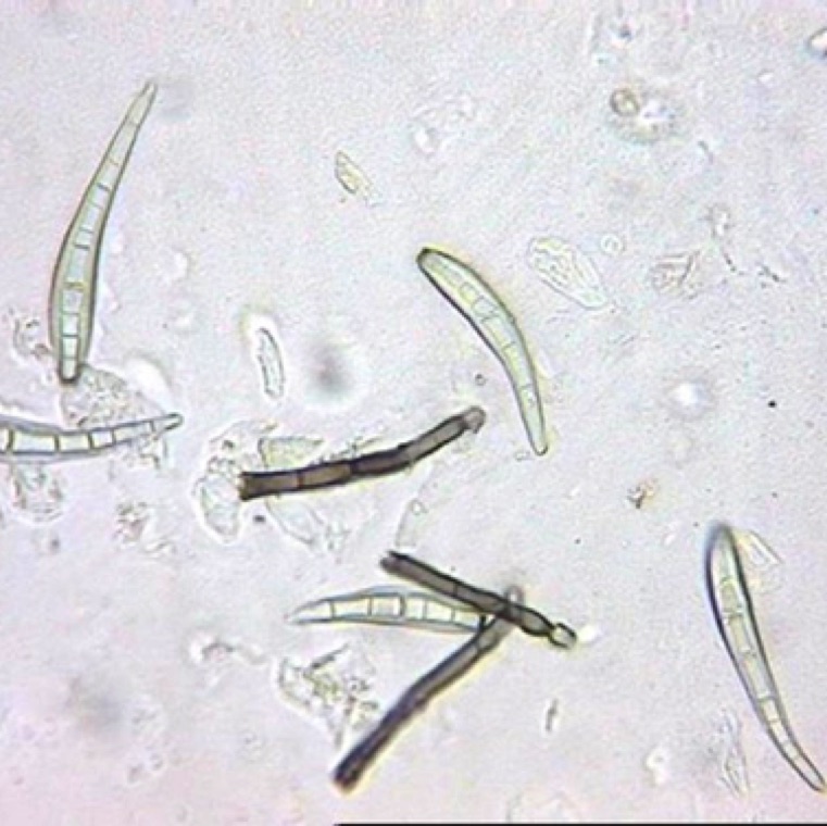 C. cassicola conidia and condiospores